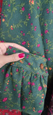 نمای مچ